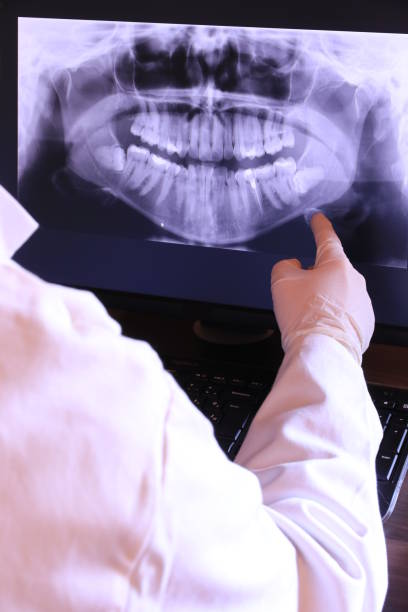 Best Emergency Treatment for Dental Infections or Abscesses in Indian Hills, NV